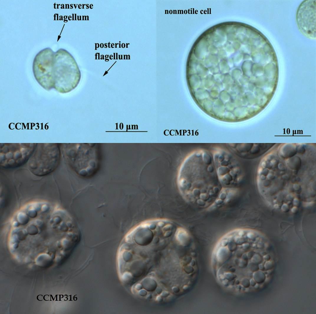 圖17.寇氏隱甲藻CCMP316株，左上圖細胞帶著鞭毛，右上圖是積累了油脂之後的形態，這個藻種是目前DHA藻油的主力生產藻種之一（要買這藻種找老倪）。